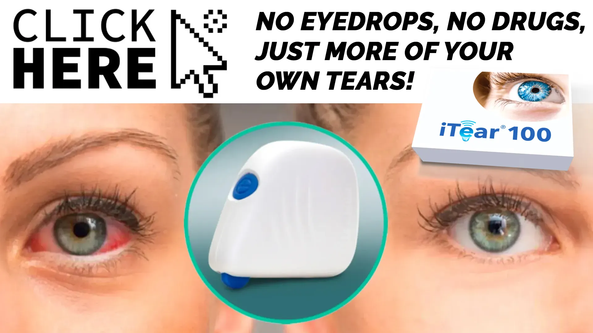 Call Now and Say Goodbye to Dry Eyes