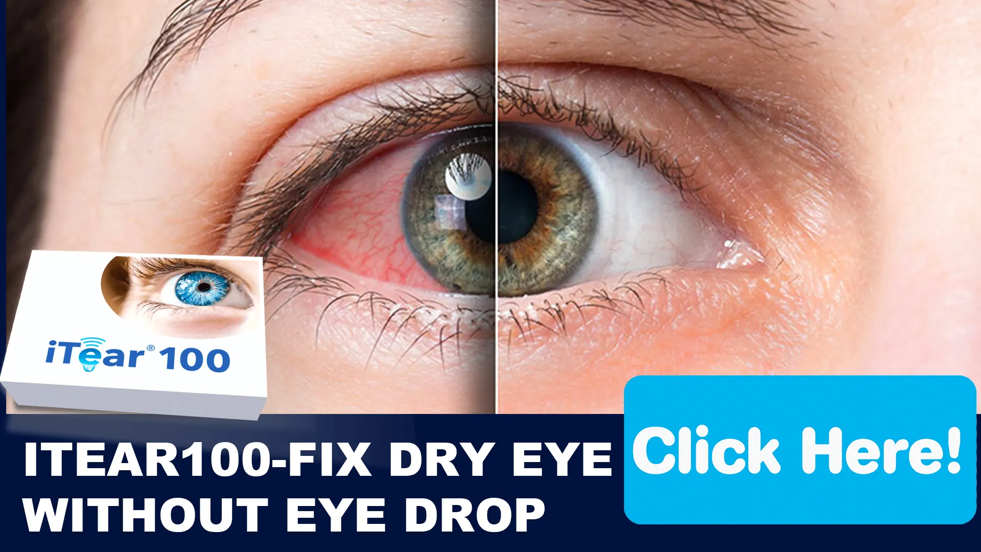 Join the Revolution in Dry Eye Relief!
